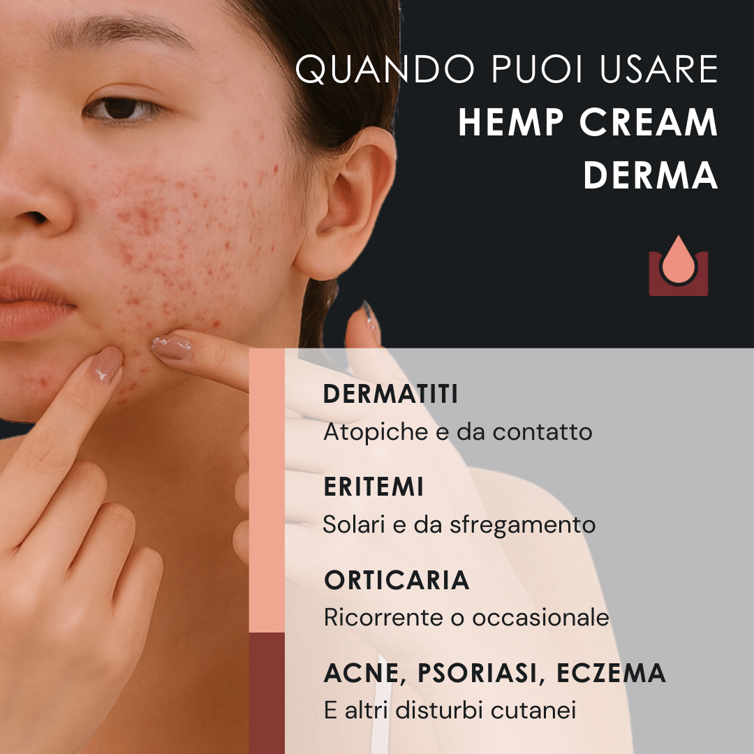 Eusphera Hemp cream Derma - Crema naturale per Psoriasi, Acne ed eczema