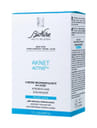 AKNET PEELING BUSTINA
