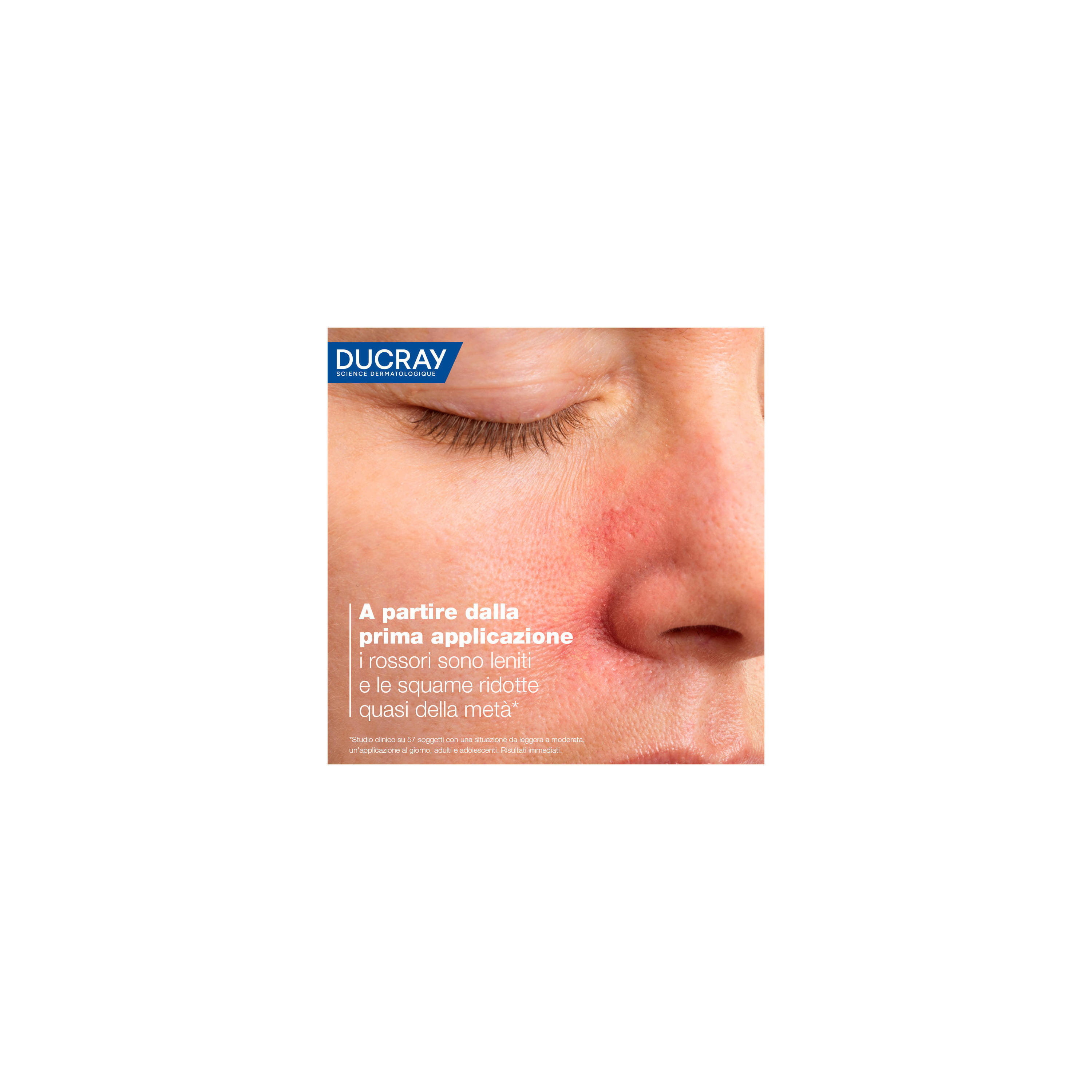 DUCRAY KELUAL DS CREMA 40 ML 23
