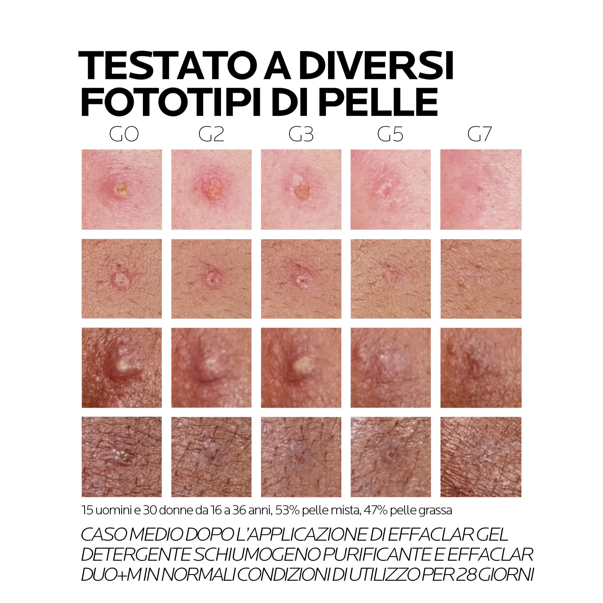 EFFACLAR DUO +M 40 ML