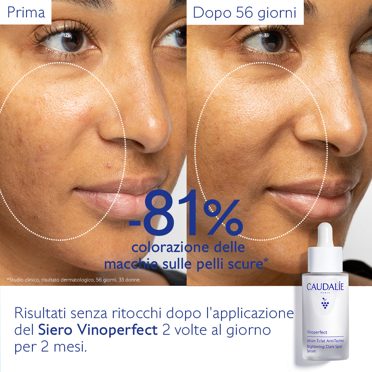 VINOPERFECT SIERO ILLUMINANTE ANTI MACCHIE 30 ML