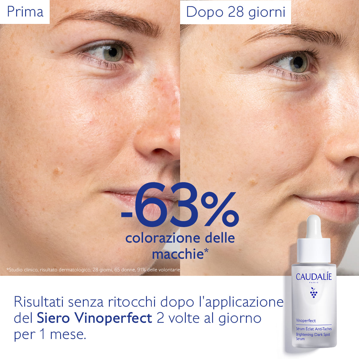 VINOPERFECT SIERO ILLUMINANTE ANTI MACCHIE 30 ML