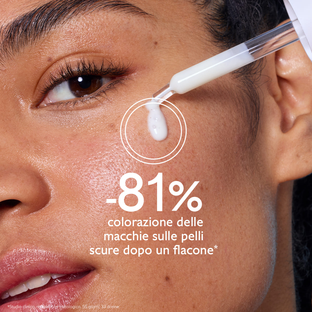 VINOPERFECT SIERO ILLUMINANTE ANTI MACCHIE 30 ML