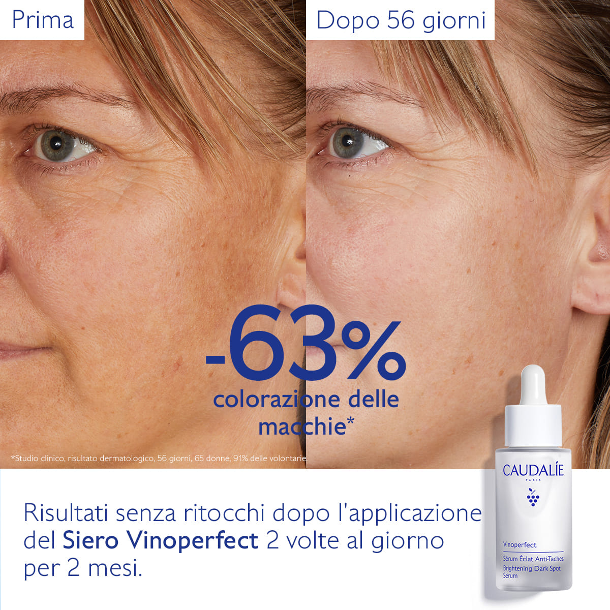 VINOPERFECT SIERO ILLUMINANTE ANTI MACCHIE 30 ML