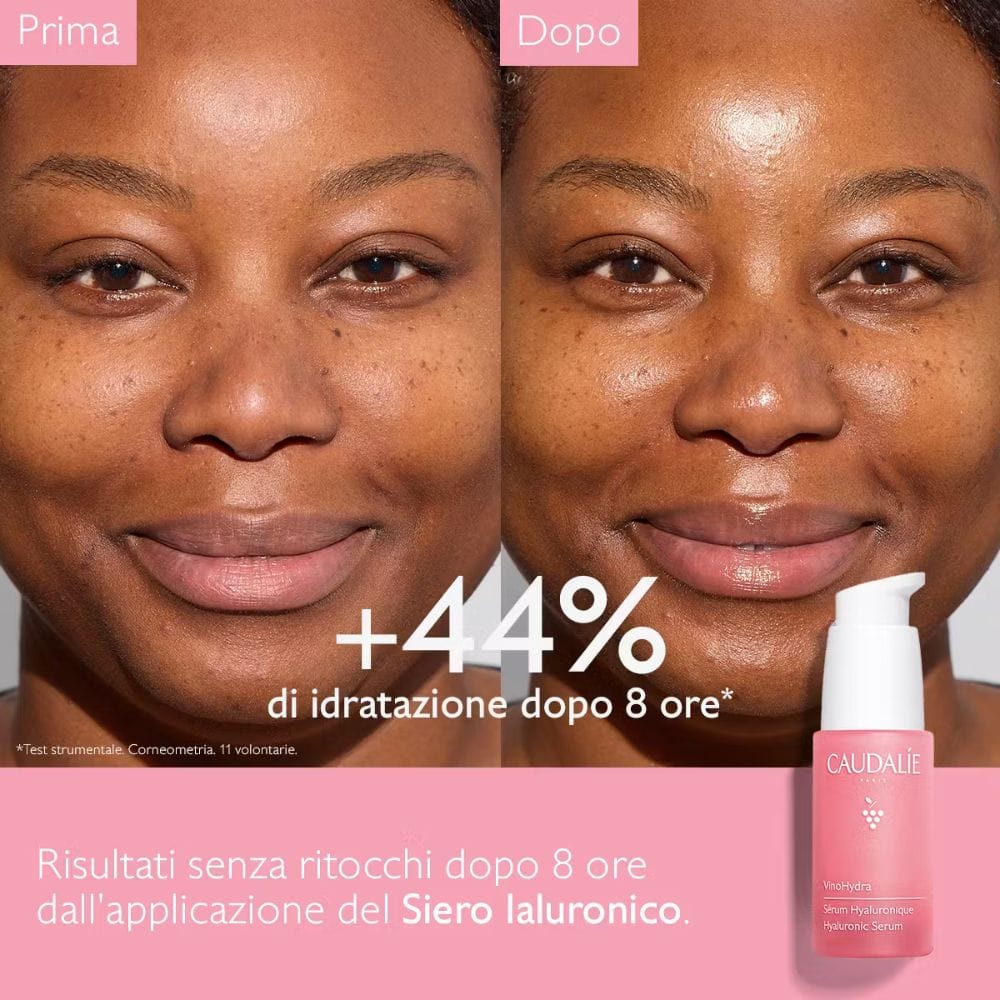VINOHYDRA SIERO IALURONICO 30 ML