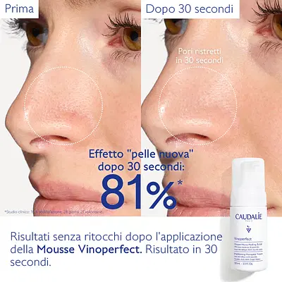 VINOPERFECT MOUSSE MICROPEELING 100 ML VINOPERFECT MOUSSE MICROPEELING 100 ML