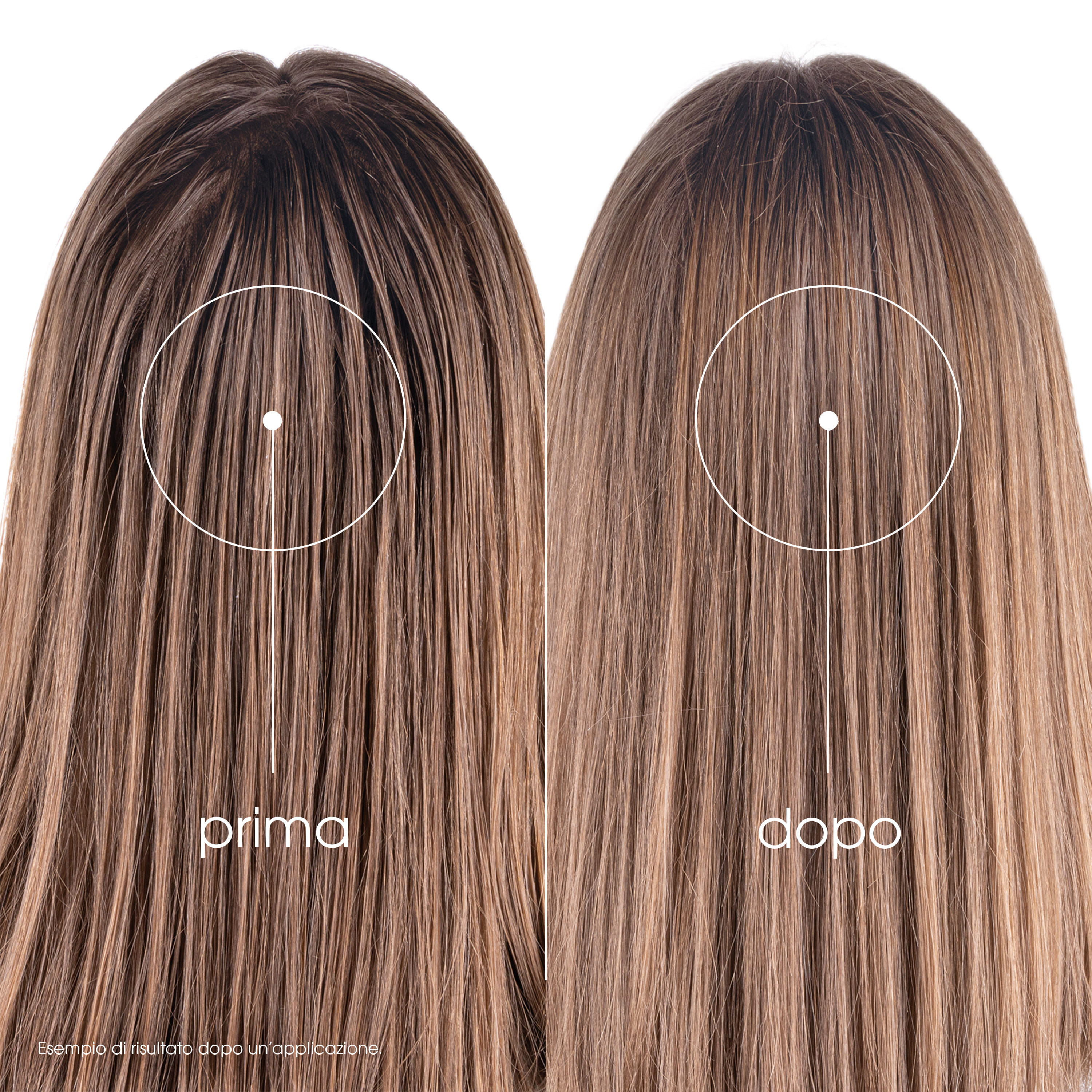 KLORANE SHAMPOO SECCO ORTICA 150 ML