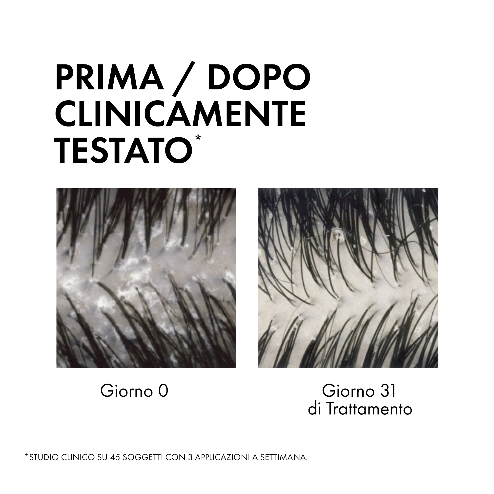 DERCOS TECHNIQUE ANTI DANDRUFF SHAMPOO 2IN1 200 ML