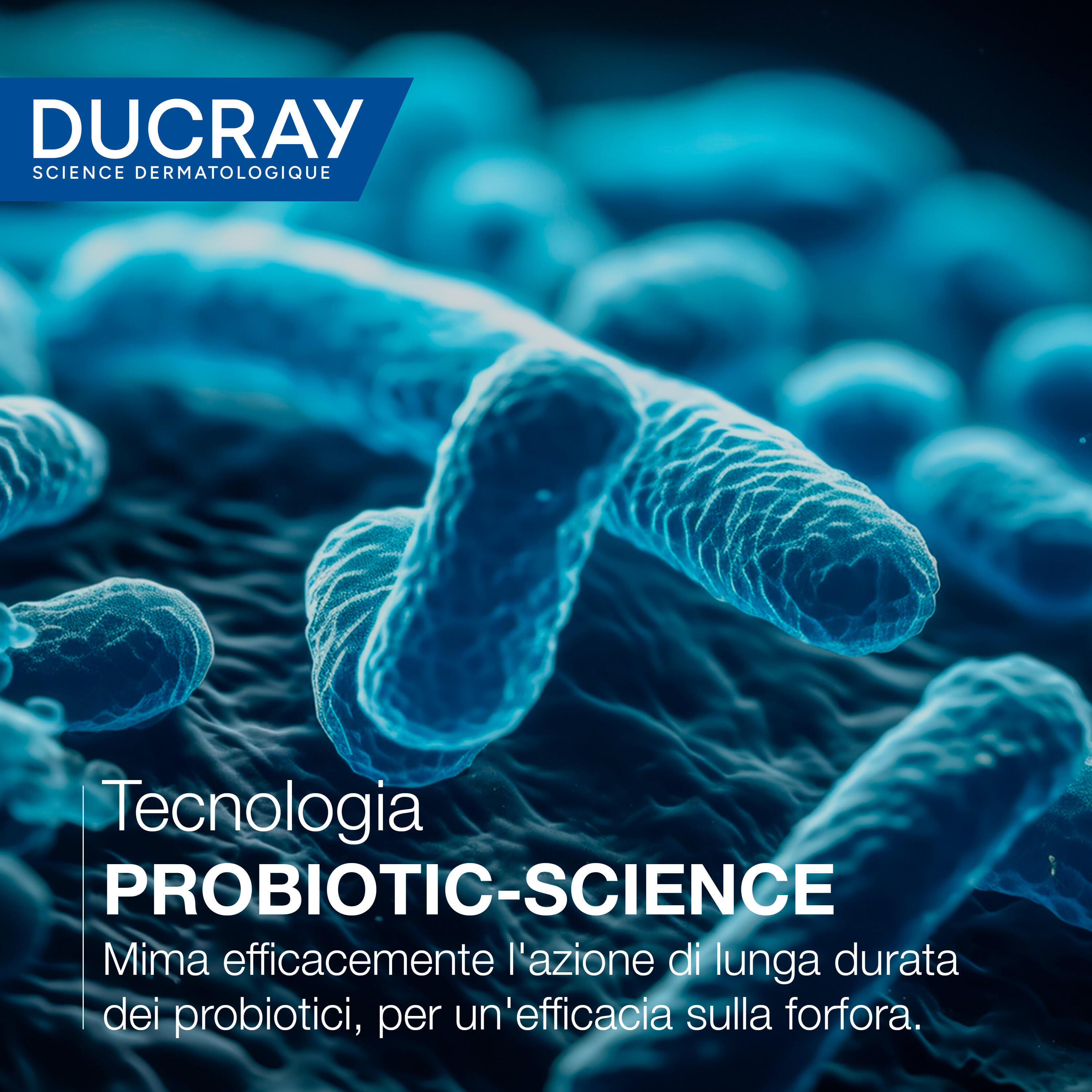 Ducray Kelual Squanorm Fresh Control Lozione, Elimina la Forfora e  Lenisce la Sensazione di Prurito, 200ml 