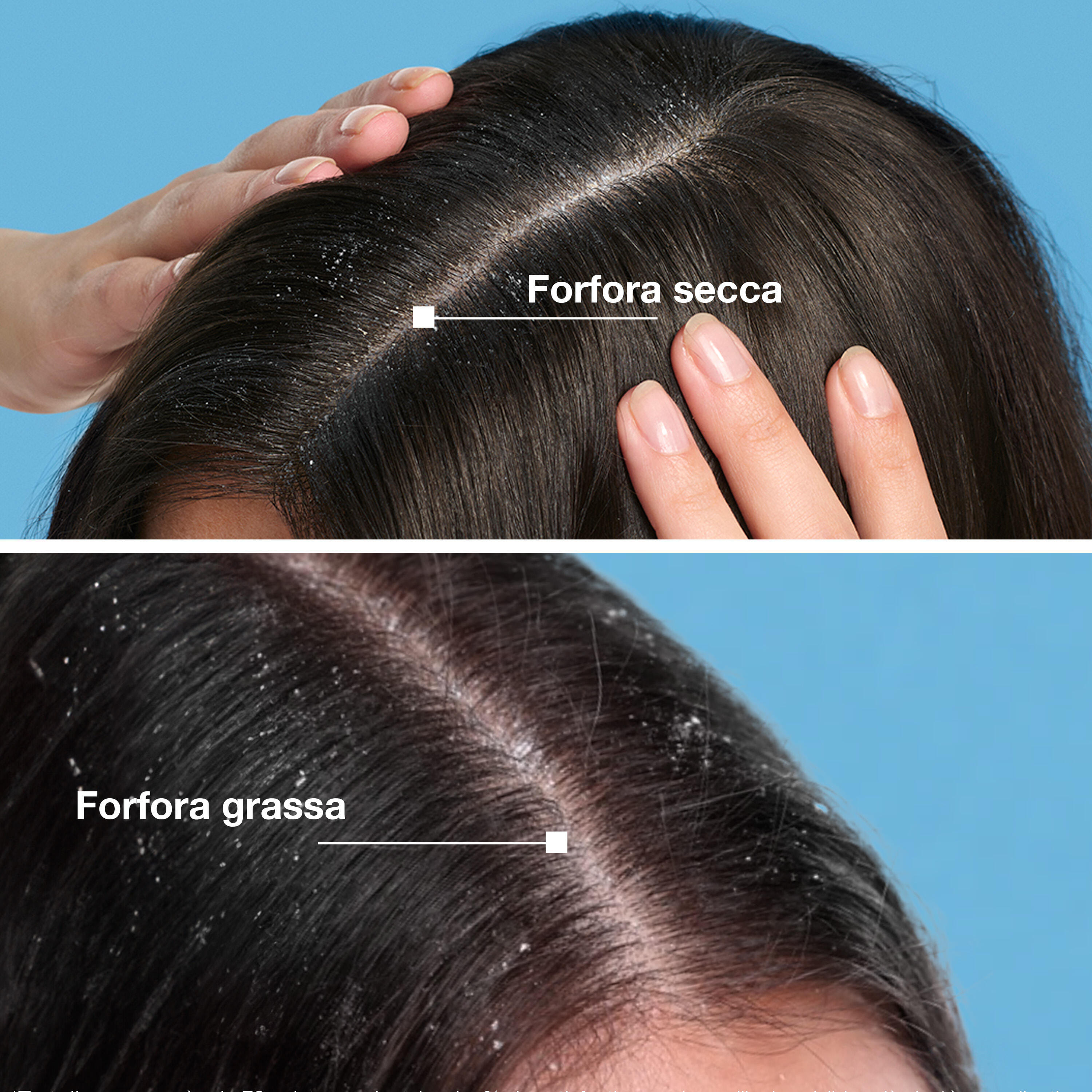 Ducray Kelual Squanorm Fresh Control Lozione, Elimina la Forfora e  Lenisce la Sensazione di Prurito, 200ml 