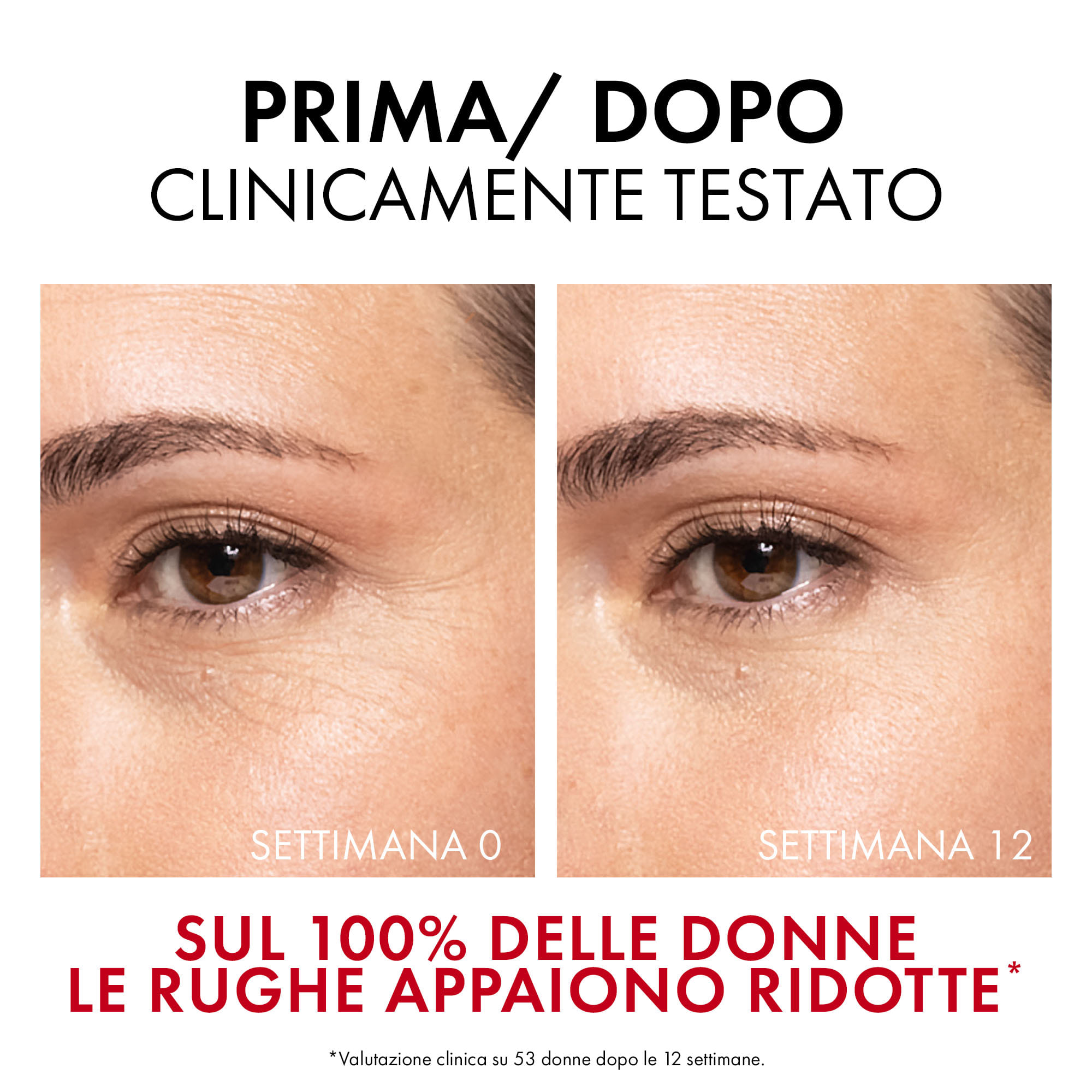 LIFTACTIV COLLAGEN SPECIALIST 16 BONDING SERUM 30 ML