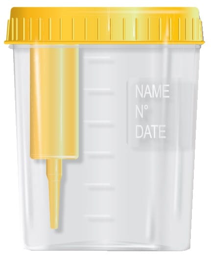 CONTENITORE PER URINE DA 120 ML CON TAPPO A VITE