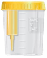 CONTENITORE PER URINE DA 120 ML CON TAPPO A VITE